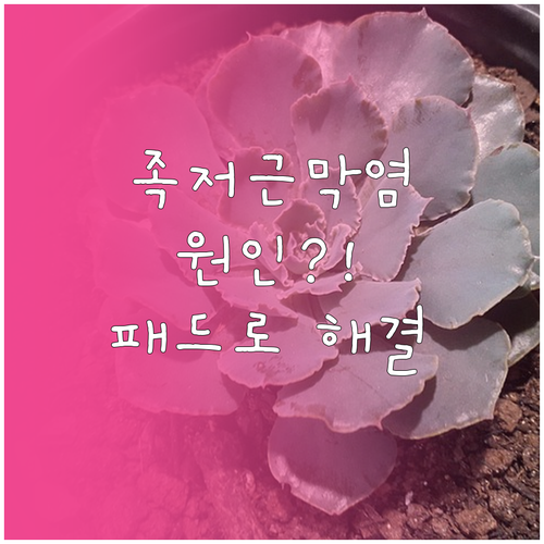 족저근막염 주요 원인과 발바닥 패드를..