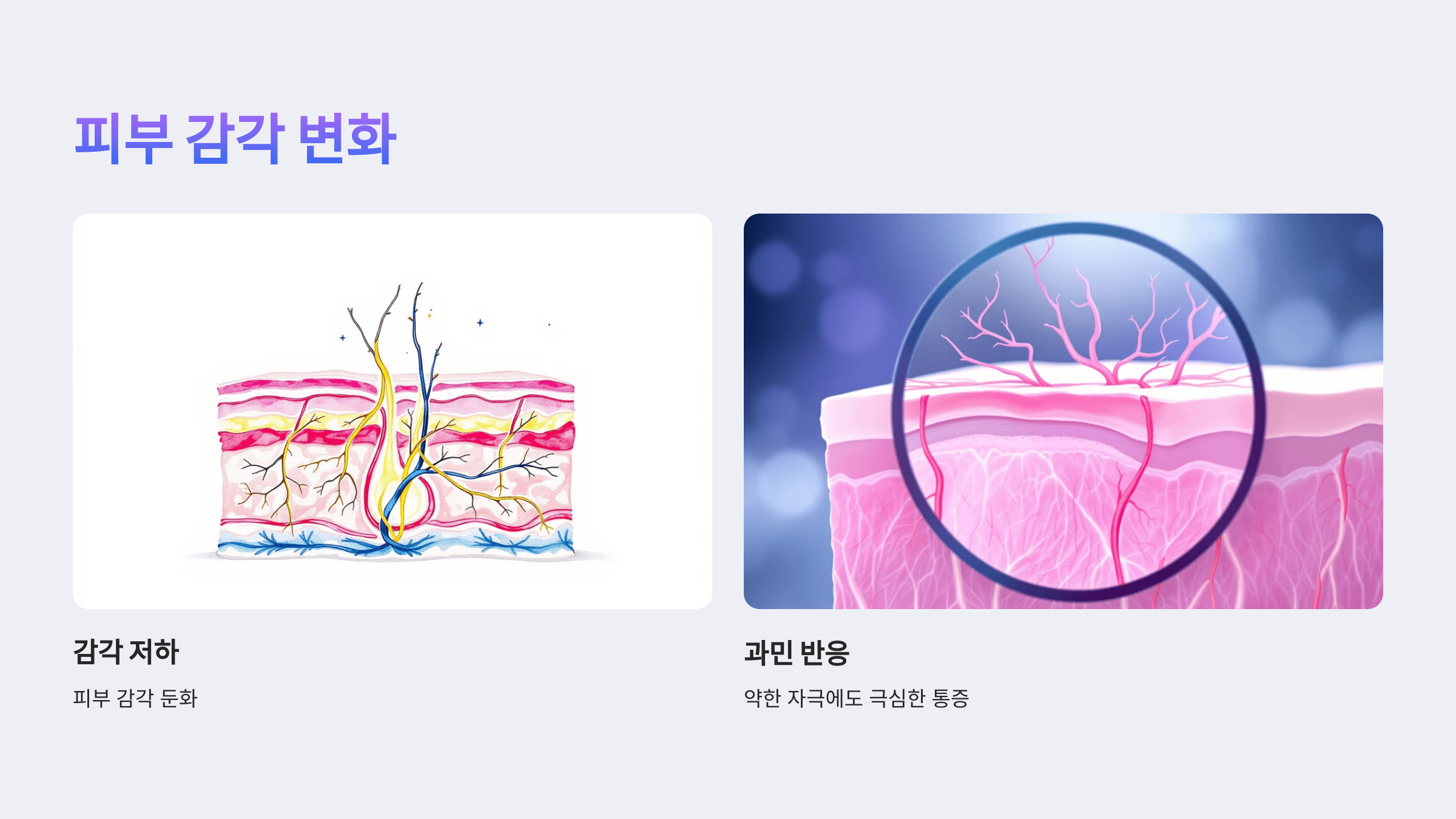 대상포진과 관련된 사진입니다.