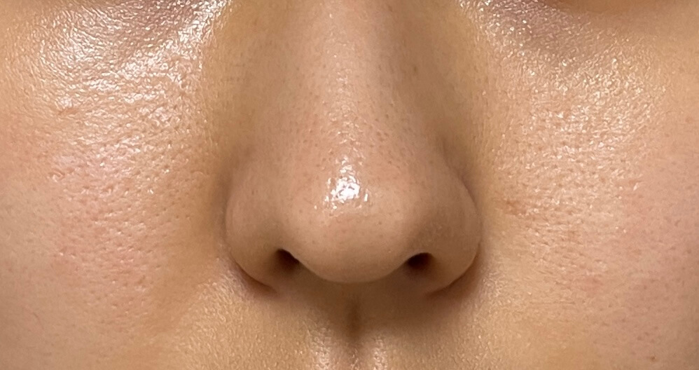 성분에디터 그린토마토 포어리프팅 앰플플러스 사용 9주차(8/11사진)