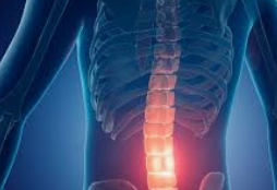 좌골신경통의 원인