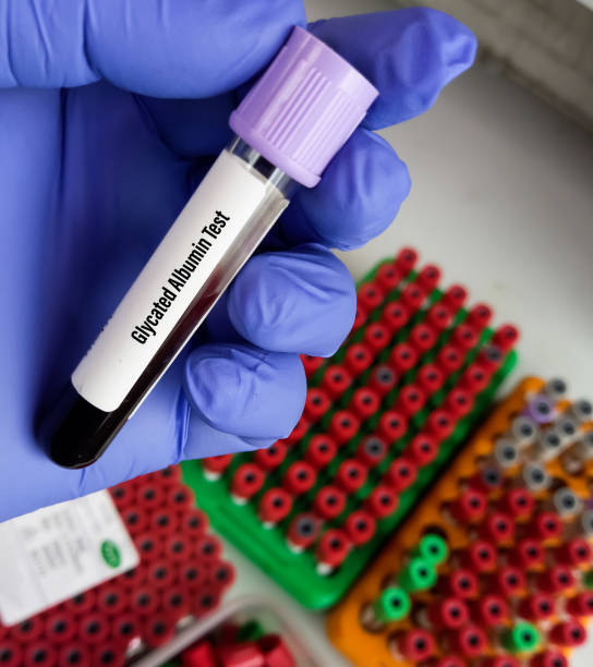 당화혈색소 정상수치 낮추는 방법