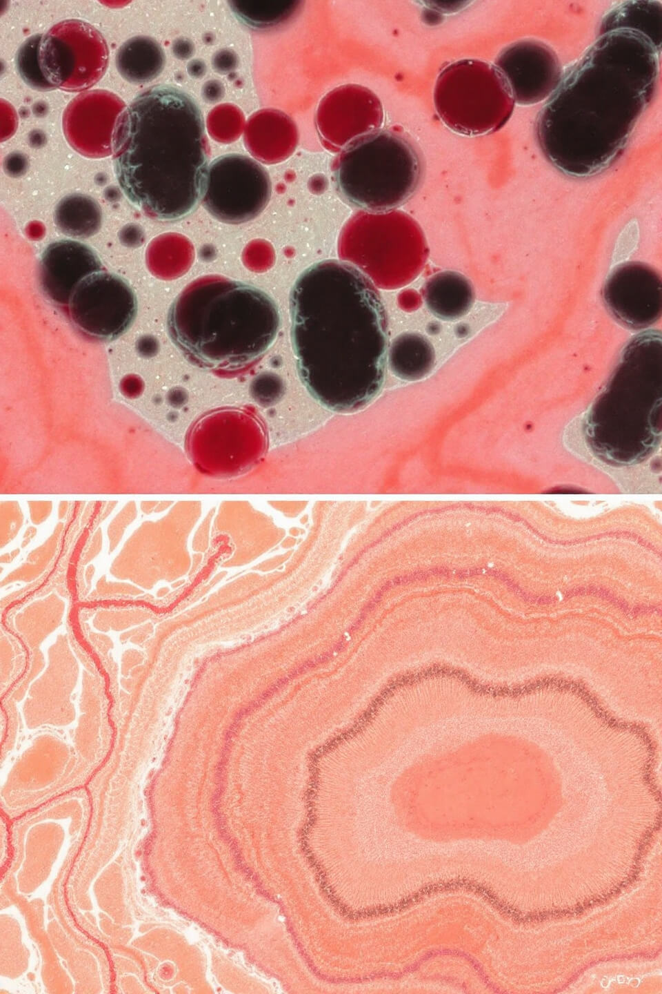 비타민K2와 관련된 사진입니다.