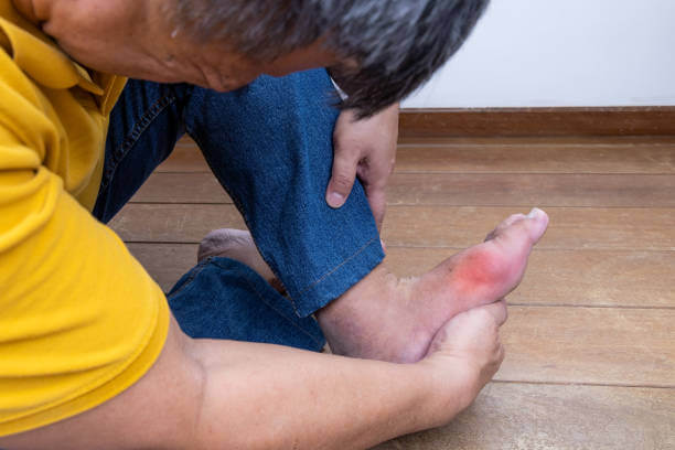 통풍에 해로운 음식과 좋은 음식 총정리