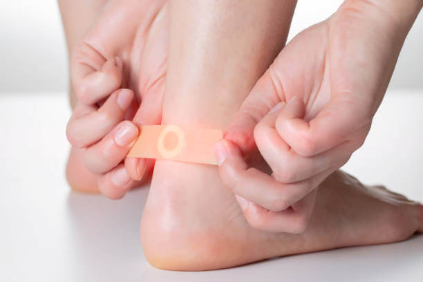 티눈 생기는 이유&amp;#44; 굳은살과 사마귀 차이 및 치료에 대해 알아봤습니다. 한번쯤은 손과 발에 티눈이 발생하는 것을 볼 수 있습니다. 티눈이 생기는 이유와 굳은살&amp;#44; 사마귀 차이점&amp;#44; 치료법&amp;#44; 티눈약 부작용 및 주의사항도 참고하시기 바랍니다. 