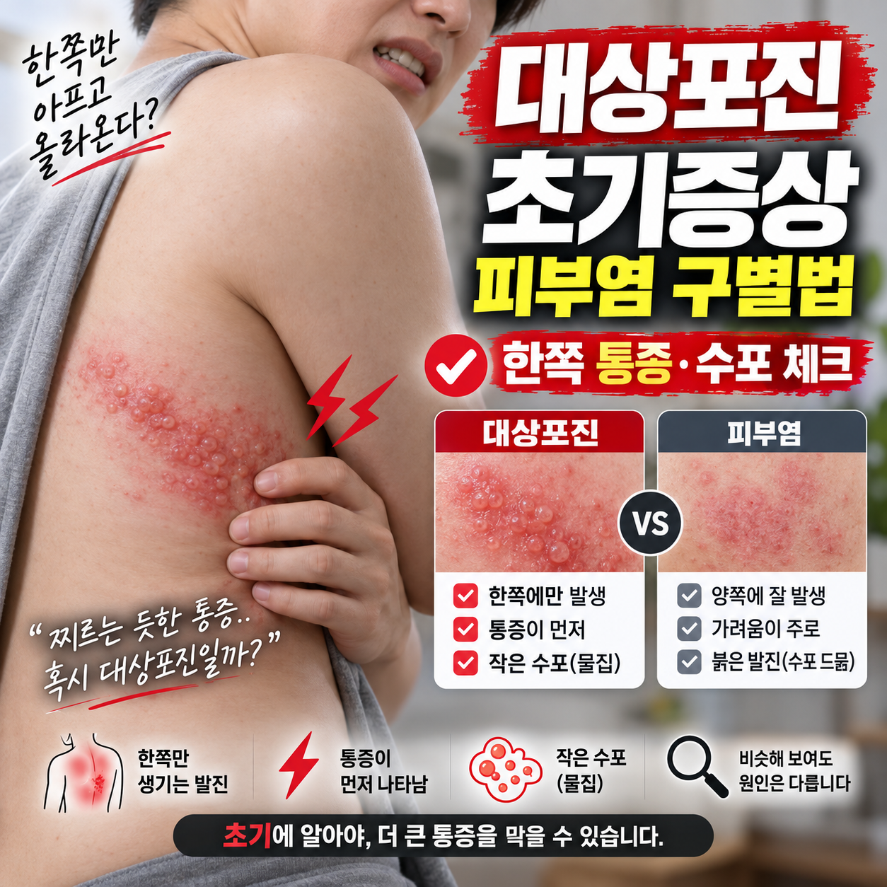 대상포진 초기증상과 피부염 구별법