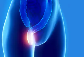 치질-증상-자가치료법-건강