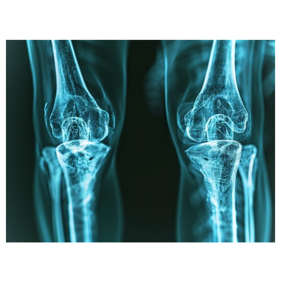 퇴행성 관절염과 관련된 사진입니다.