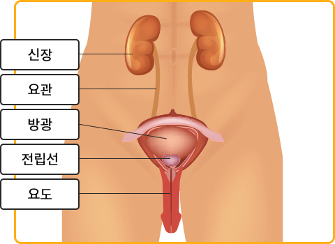 요실금 치료방법&amp;#44; 요실금 수술 비용&amp;#44; 요실금 팬티&amp;#44; 요실금 치료기 추천&amp;#44; 요실금 병원