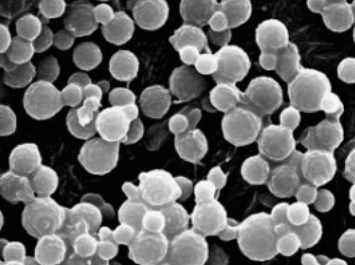 말라쎄지아(진균성 모낭염) 