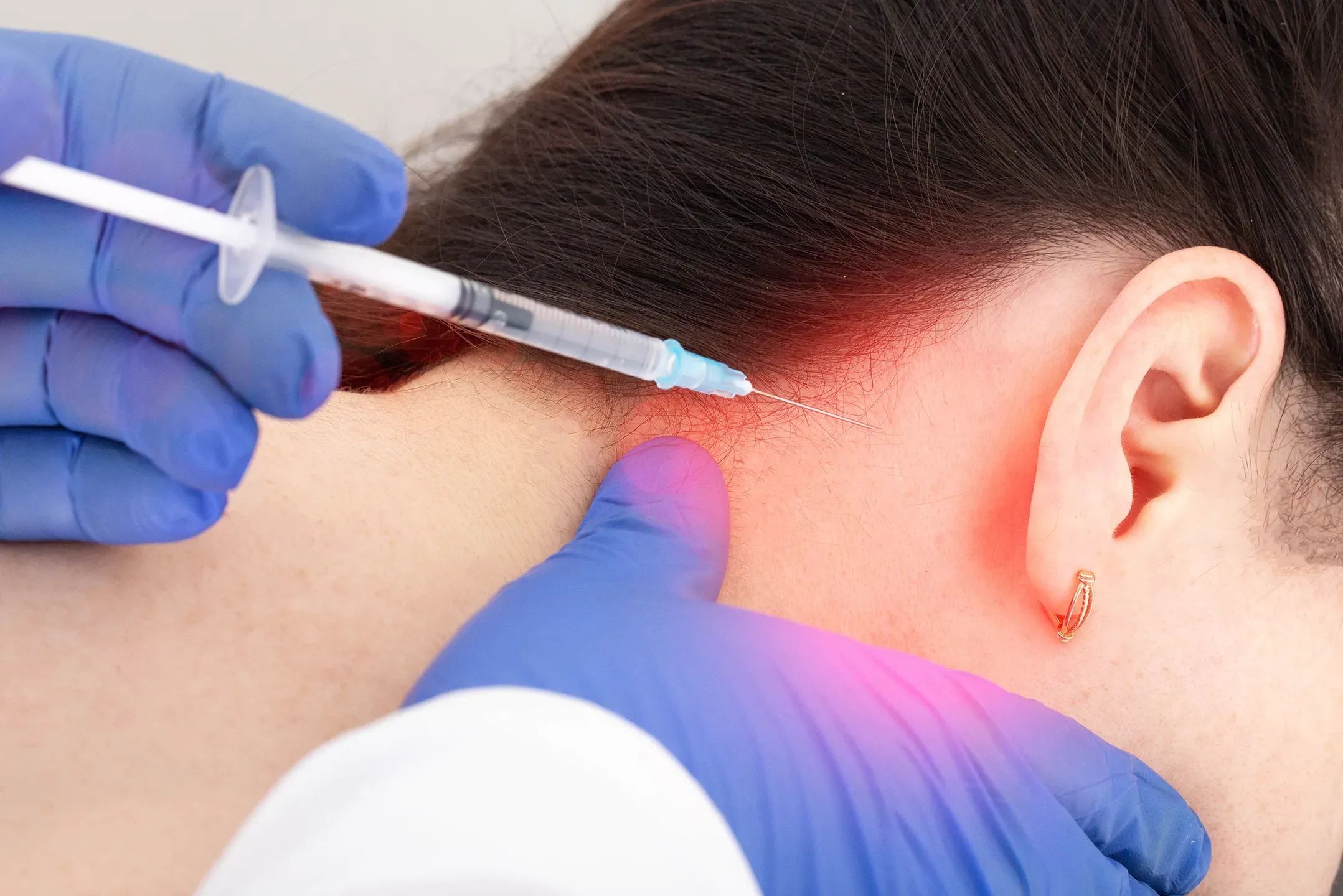 신경 주사 치료 종합 가이드