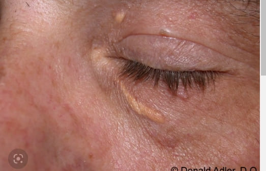 건강의 거울 '얼굴'에 나타나는 병