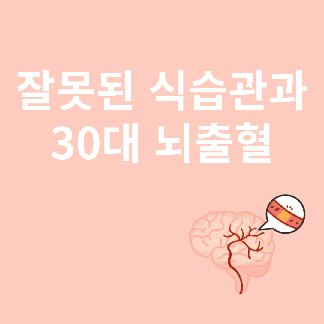 뇌출혈과 관련된 이미지