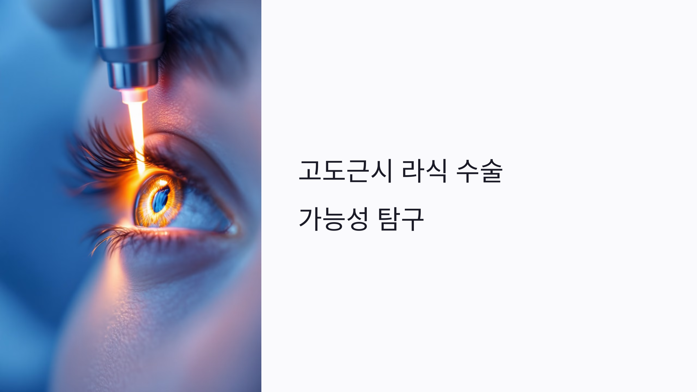 고도근시 라식 수술 가능할까? 각막 두께 기준부터 성공률