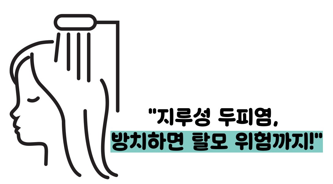 지루성 두피염