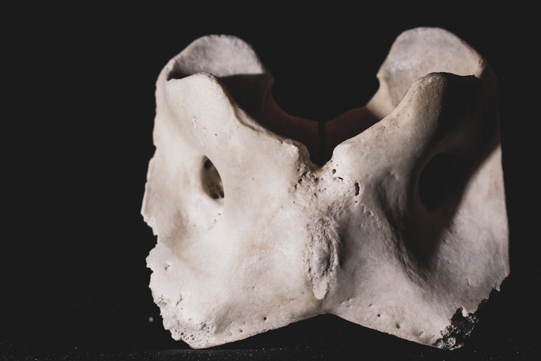 Bone.