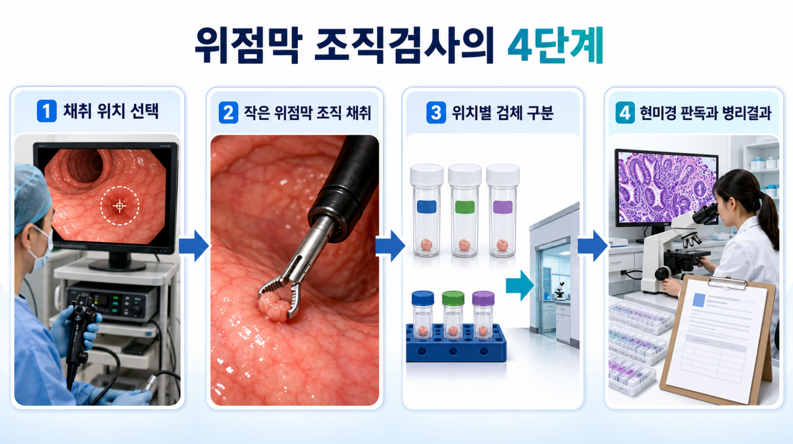 위내시경 채취 위치 선택부터 현미경 판독과 병리결과까지의 4단계