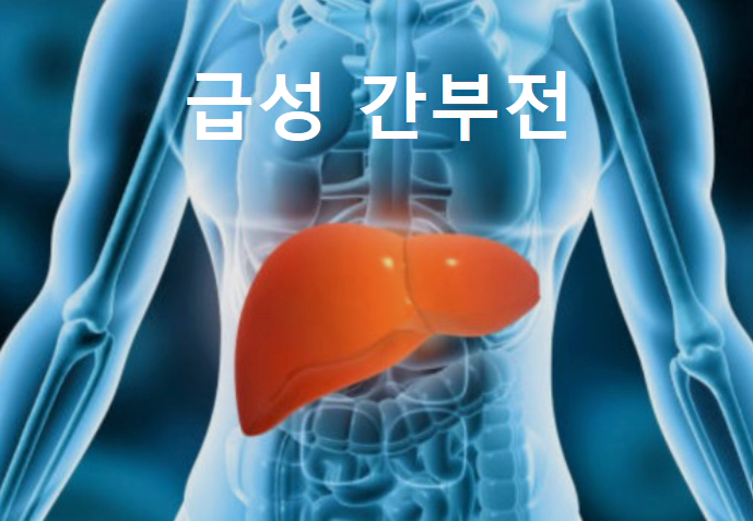 급성-간부전-원인-증상