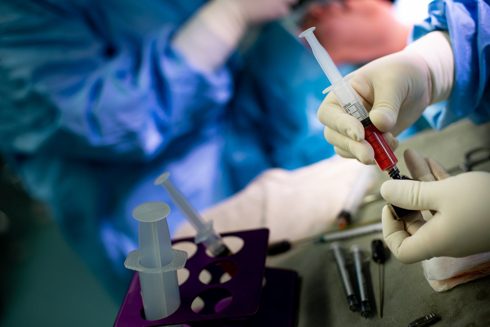 지방이식 동안 시술: 자연스럽고 오래가는 볼륨 개선