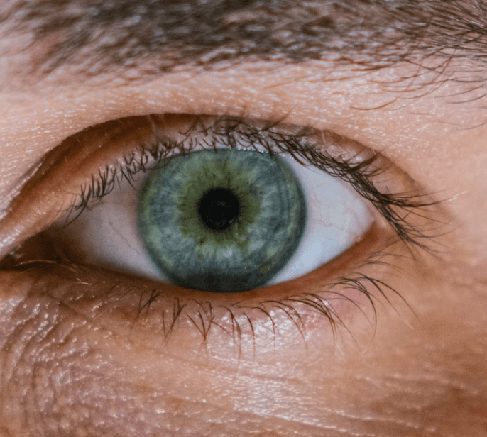 녹내장 초기증상 - 정기검사