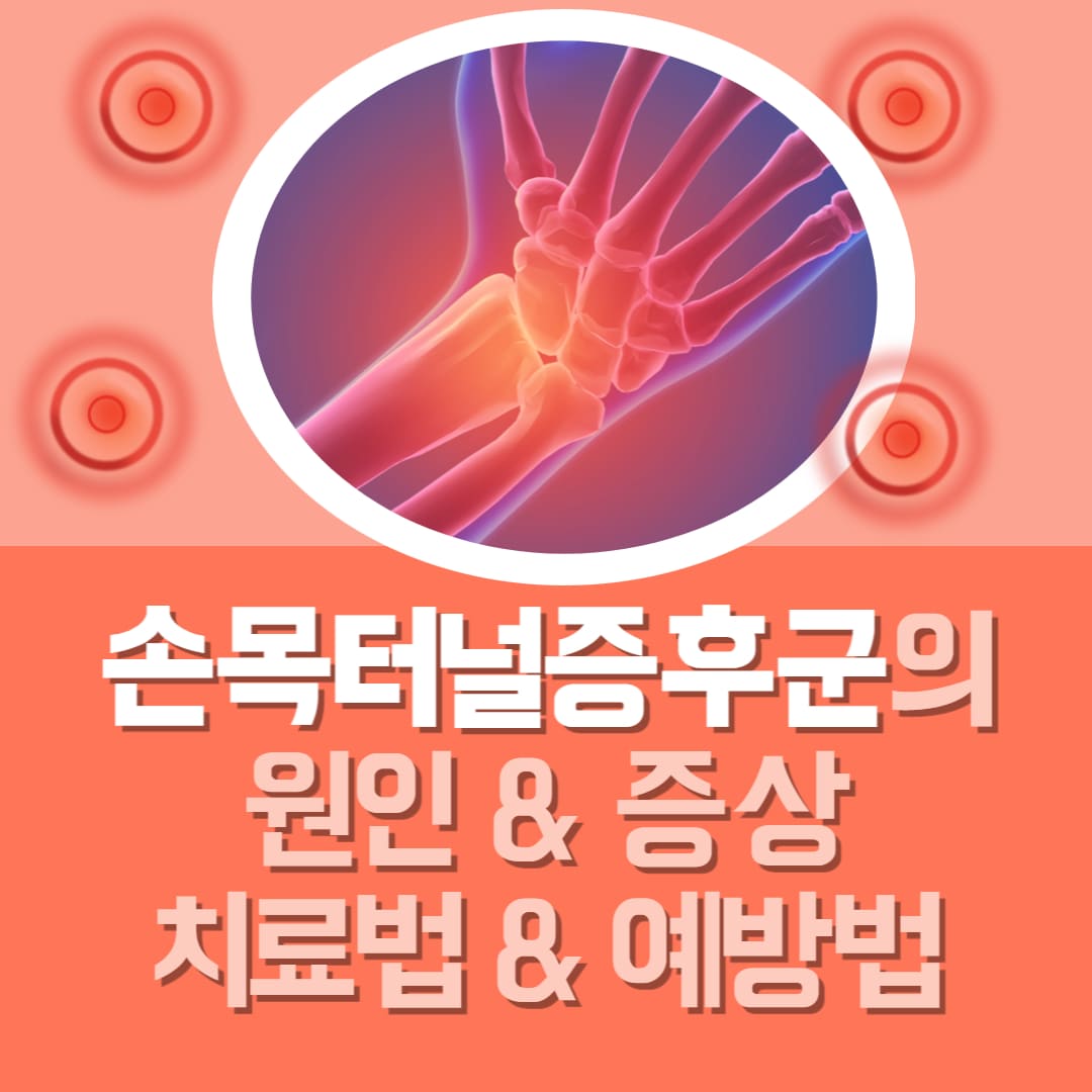 손목터널증후군