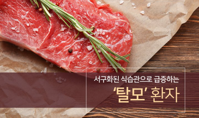 식습관에 의한 여성탈모 원인과 치료 예방법