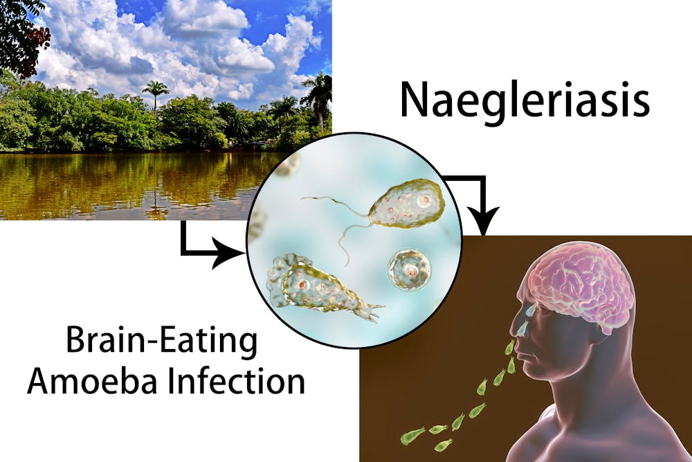 Naegleria fowleri(네글레리아 파울러리)