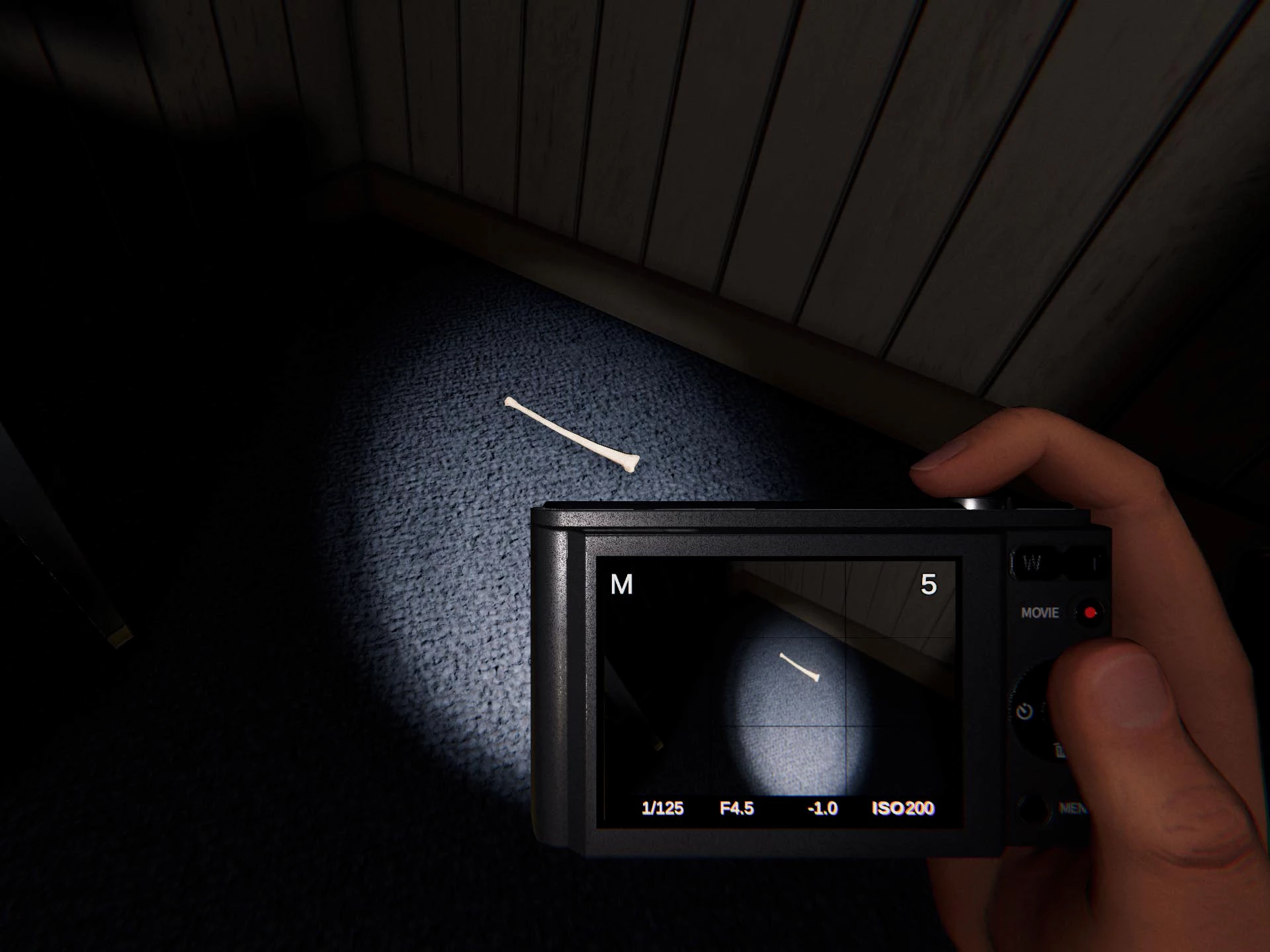 파스모포비아 뼈 사진