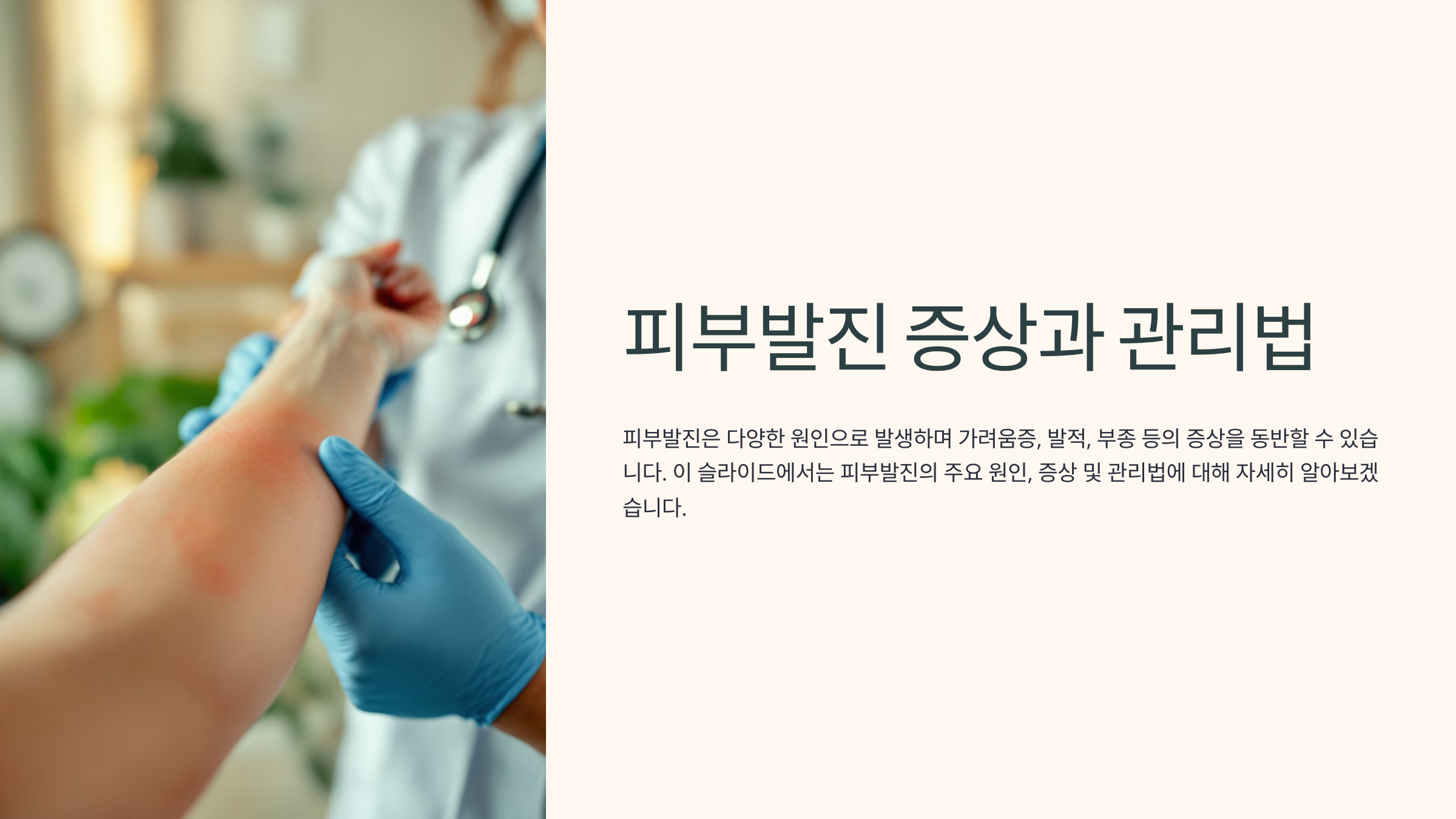 피부발진 증상과 관리법