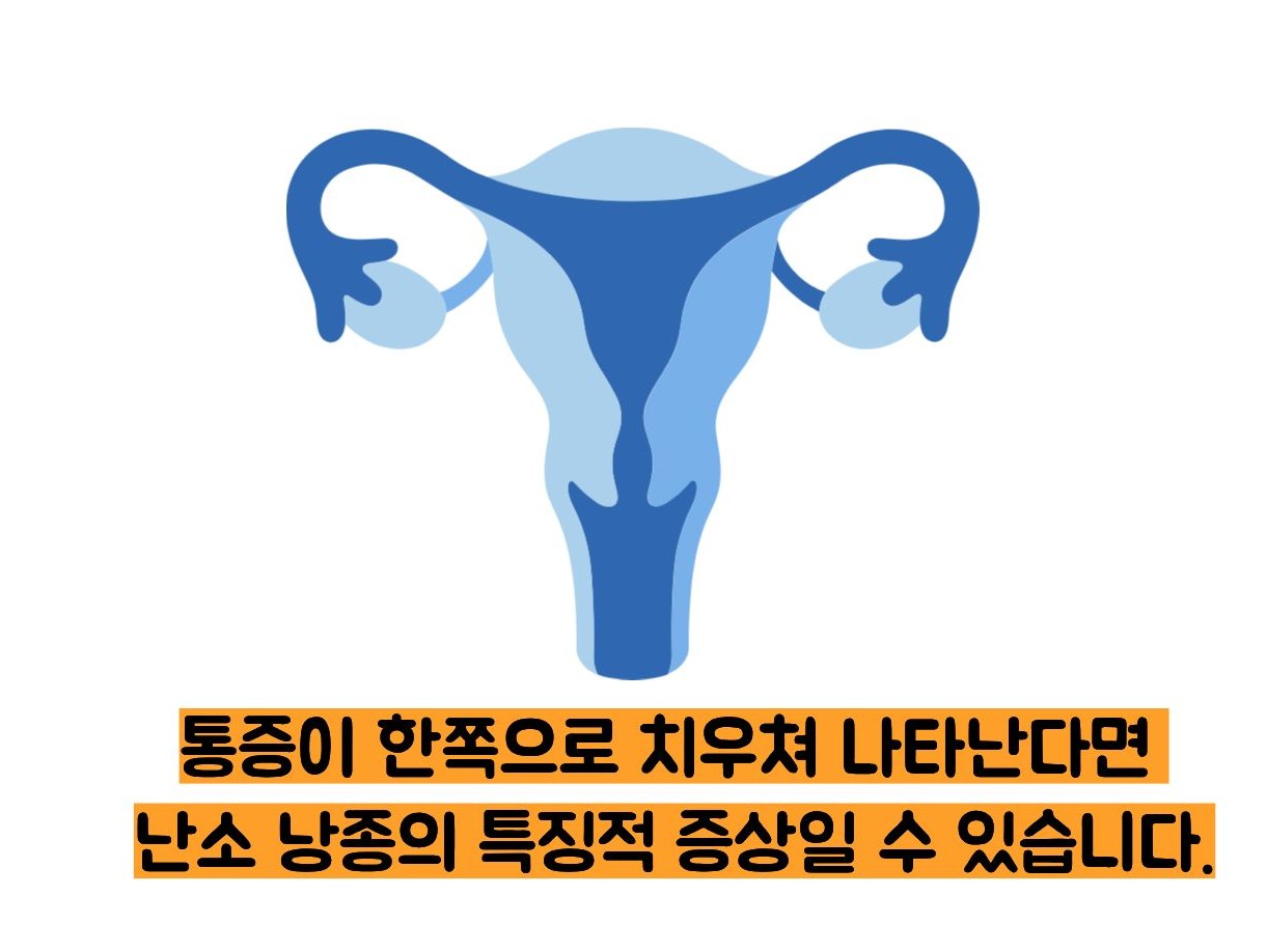 난소 낭종의 증상