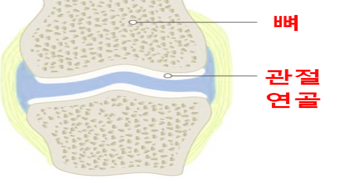 관절 연골 사진