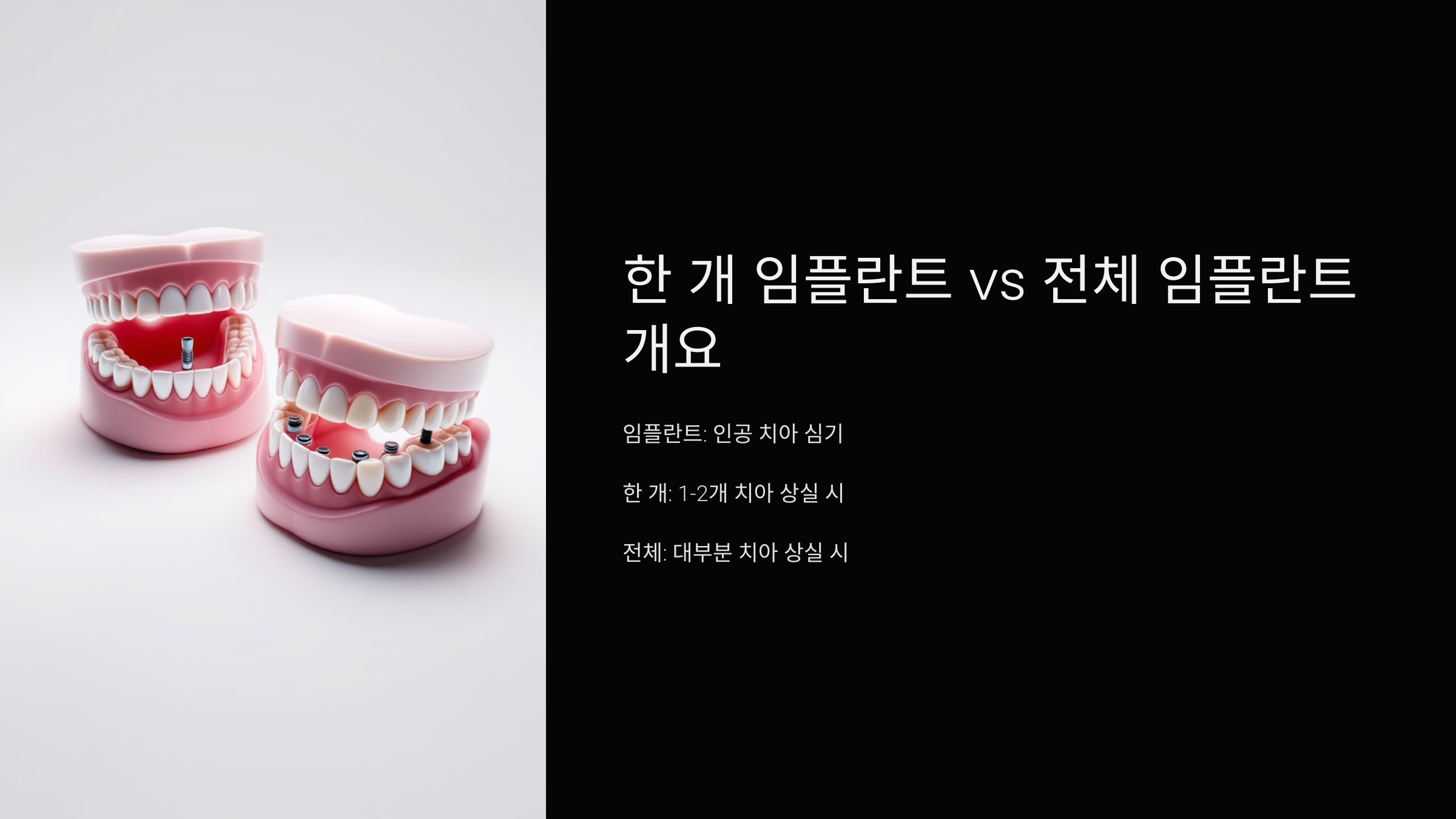 한 개 임플란트 vs 전체 임플란트 개요