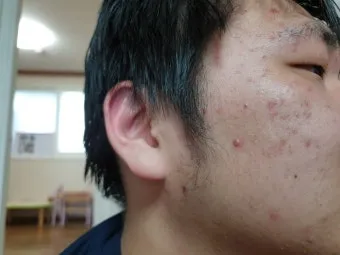 병풀 상처연고 상처 치유 피부 재생 효능과 사용법_28