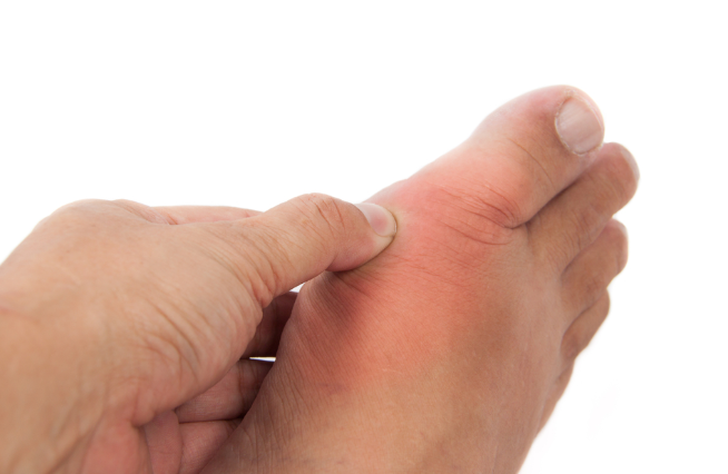 엄지 발가락 옆 통증