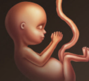 아기 탯줄 제대혈