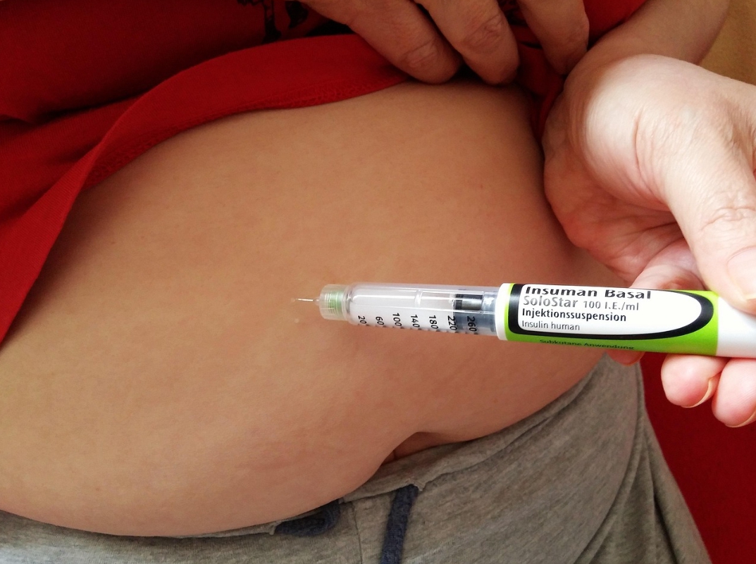 남성의 배에 인숄린 주사를 맞고 있는 사진