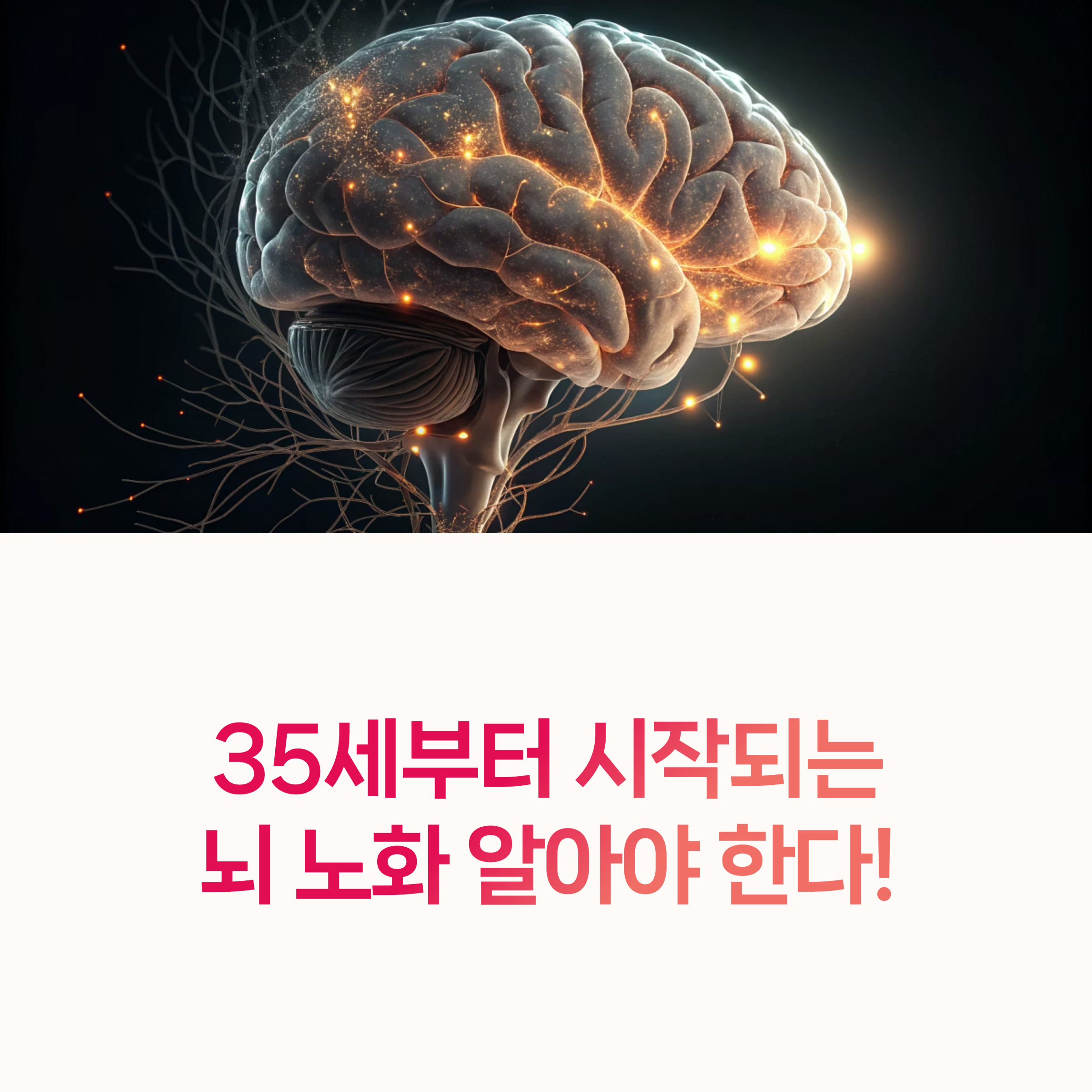 뇌건강, 중장년치매예방,