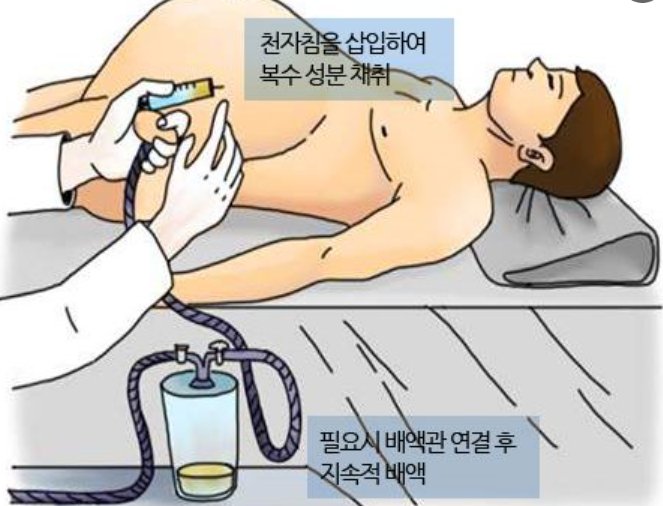 복수천자-앙와위