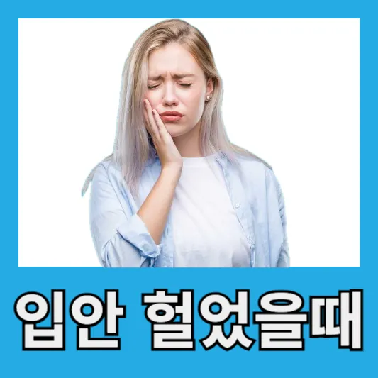 입안 헐었을때 꿀팁 구내염 혓바늘 헐었을때 연고 오라메디 연고 페리덱스