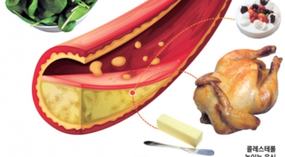 콜레스테롤 이미지