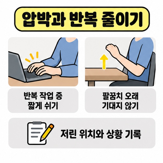 반복 작업 중 짧게 쉬고 팔꿈치를 오래 기대지 않는 생활 습관 및 저린 위치와 상황 기록 안내