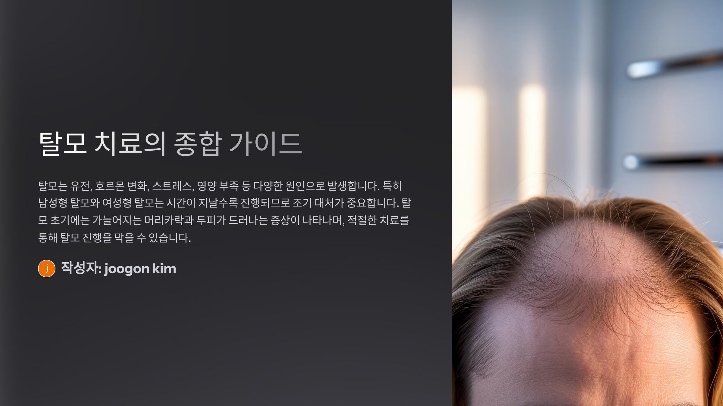 탈모 치료 방법