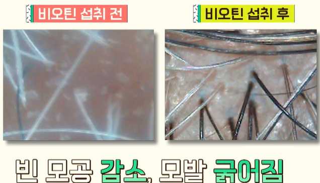비오틴 효능