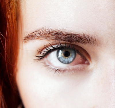 눈 다래끼 원인과 빨리 낫는 법