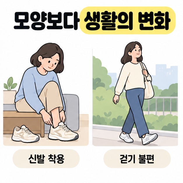 모양보다 생활의 변화라는 제목 아래 신발을 신는 장면과 야외에서 걷는 장면을 나란히 배치한 그림