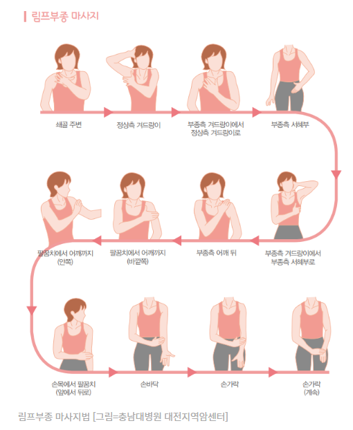 림프부종 마사지 순서
림프부종 마사지는 몸 중심에서부터 시작해서 몸에서 먼 곳으로 진행해야 효과가 있다.