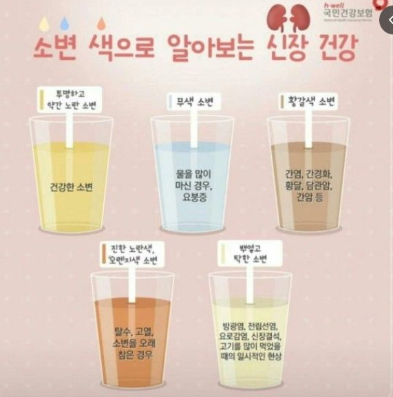 소변색깔로 보는 건강/출처:국민건강