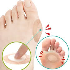 티눈이 생기는 이유