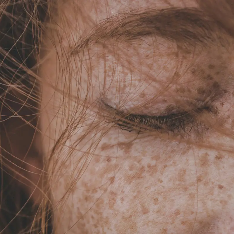 중년 여성 피부노화에 콜라겐 효과 있나요? 잡티까지 개선될까