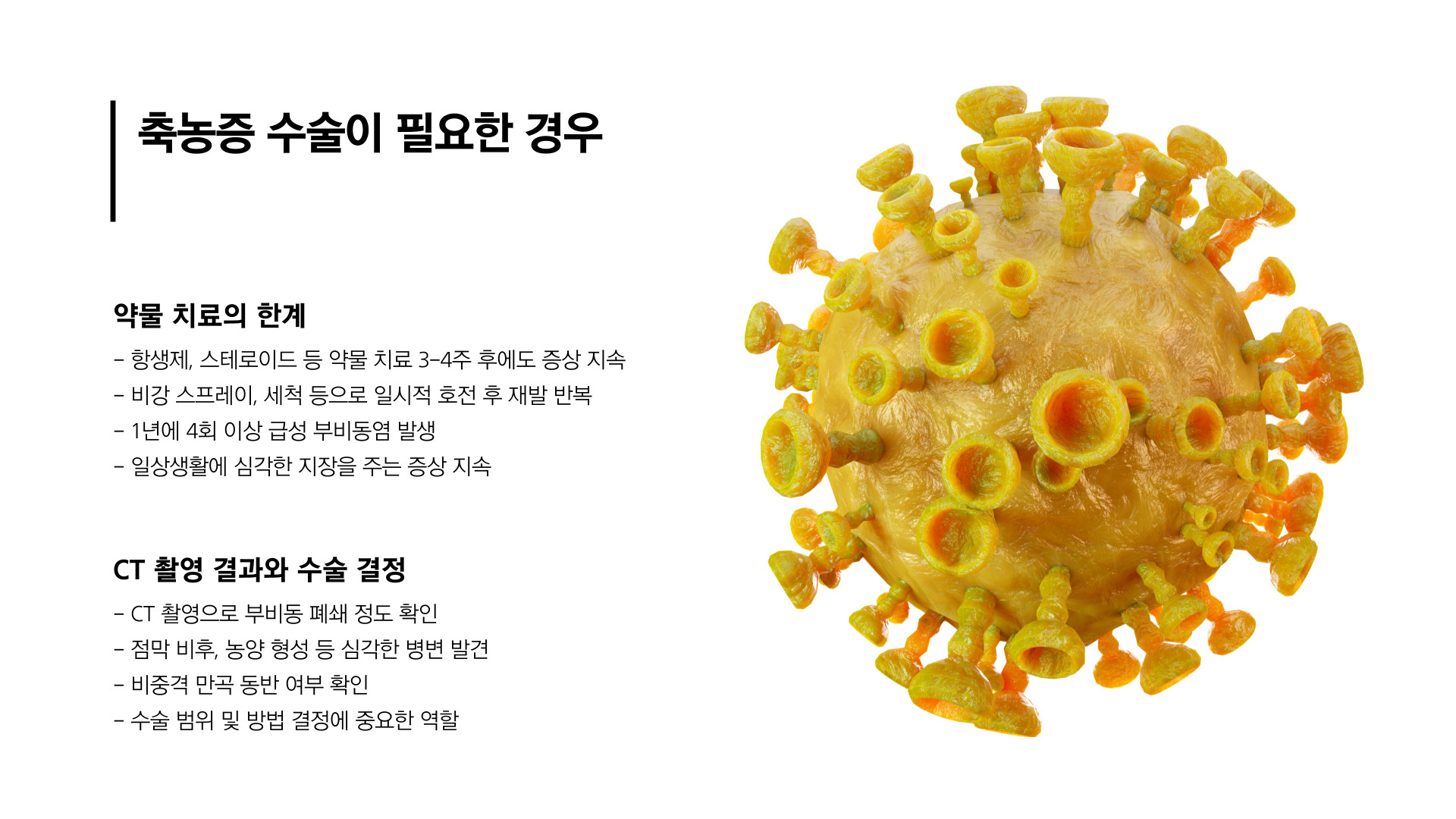 축농증 수술 비용