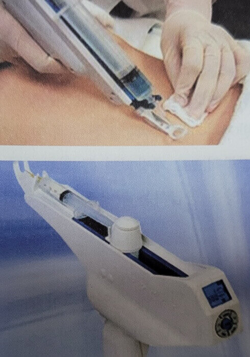 mesotherpy 이미지